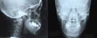 歯・頭部のレントゲン写真